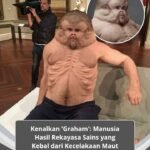 Kenalkan “Graham”: Manusia Hasil Rekayasa Sains Yang Kebal Dari Kecelakaan Maut Paling Tragis!